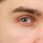 眉毛からフケが出る 5つの原因と対策方法を紹介 グラビネス Grabiness
